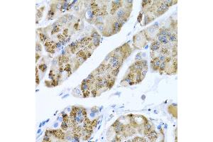 Immunohistochemistry of paraffin-embedded human stomach using MGP antibody at dilution of 1:100 (40x lens). (MGP anticorps)