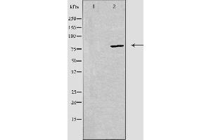 Western blot analysis of extracts from 293 cells, using ADD2 antibody. (ADD2 anticorps  (Internal Region))
