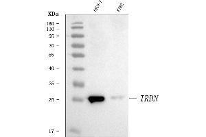 Western blot analysis of Triadin/TRDN using anti-Triadin/TRDN antibody (ABIN7602275).