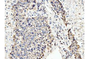 IHC analysis of BCKDK using anti-BCKDK antibody (ABIN7601470). (BCKDK anticorps  (AA 36-316))