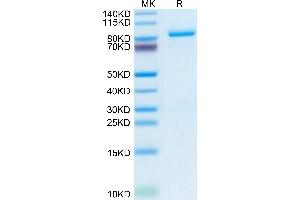 Human Periostin/OSF-2 on Tris-Bis PAGE under reduced condition. (Periostin Protein (POSTN) (AA 22-836) (His tag))