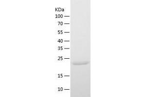 Western Blotting (WB) image for Cathepsin F (CTSF) (AA 273-484) protein (His-IF2DI Tag) (ABIN7122180)