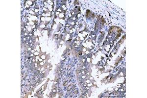 IHC analysis of Chromogranin A/Chga using anti-Chromogranin A/Chga antibody (ABIN7601533).