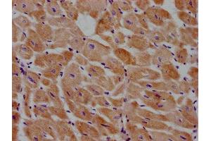 IHC image of ABIN7140064 diluted at 1:100 and staining in paraffin-embedded human heart tissue performed on a Leica BondTM system.