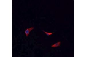 ABIN6266693 staining HeLa cells by IF/ICC. (BCKDK anticorps  (N-Term))