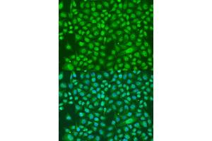 Immunofluorescence analysis of U2OS cells using KDM7A antibody (ABIN6293223) at dilution of 1:100.