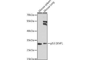 Western blot analysis of extracts of various cell lines, using p53 DINP1 antibody (ABIN6133846, ABIN6149422, ABIN6149423 and ABIN6224287) at 1:1000 dilution. (TP53INP1 anticorps  (AA 1-100))