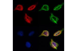 ABIN6261208 and ABIN6268648 staining Hela by IF/ICC. (Cytokeratin 13 anticorps  (Internal Region))