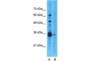 Host:  Rabbit  Target Name:  GAPDH  Sample Type:  293T  Lane A:  Primary Antibody  Lane B:  Primary Antibody + Blocking Peptide  Primary Antibody Concentration:  1ug/ml  Peptide Concentration:  5ug/ml  Lysate Quantity:  25ug/lane/lane  Gel Concentration:  0.