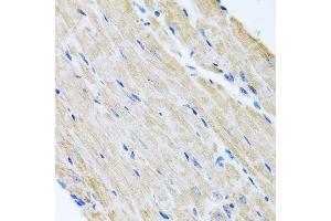 Immunohistochemistry of paraffin-embedded mouse heart using ABCB8 antibody.