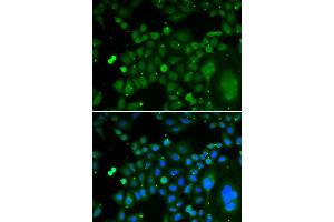 Immunofluorescence (IF) image for anti-TAR DNA Binding Protein (TARDBP) (AA 1-260) antibody (ABIN3021656)
