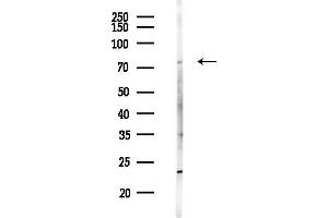 anti-Interleukin 4 Induced 1 (IL4I1) (C-Term) antibody