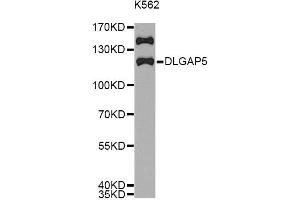 Western blot analysis of extracts of K562 cells, using DLGAP5 antibody. (DLGAP5 anticorps)