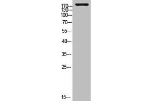 Western Blot analysis of customer's (cat sample) using Laminin γ-1 Polyclonal Antibody (Laminin gamma 1 anticorps  (C-Term))