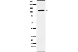 Western blot analysis of Eph receptor B1 expression in U87MG cell lysate.