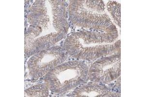 Immunohistochemical staining of human stomach with LRCH2 polyclonal antibody  shows cytoplasmic and membranous positivity in glandular cells. (LRCH2 anticorps)