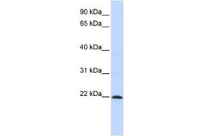 WB Suggested Anti-ZNF581 Antibody Titration:  0. (ZNF581 anticorps  (N-Term))
