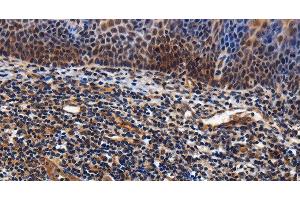 Immunohistochemistry of paraffin-embedded Human tonsil tissue using LRRC57 Polyclonal Antibody at dilution 1:40 (LRRC57 anticorps)