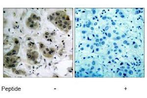 Image no. 1 for anti-V-Akt Murine Thymoma Viral Oncogene Homolog 1 (AKT1) (Ser473) antibody (ABIN197193) (AKT1 anticorps  (Ser473))