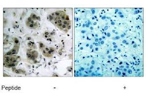 Image no. 1 for anti-V-Akt Murine Thymoma Viral Oncogene Homolog 1 (AKT1) (Ser473) antibody (ABIN197193) (AKT1 anticorps  (Ser473))
