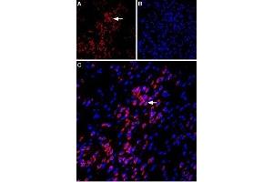 Expression of VPAC1 in rat amygdala - Immunohistochemical staining of immersion-fixed, free floating rat brain frozen sections using Anti-VPAC1 (VIPR1) (extracellular) Antibody (ABIN7043875, ABIN7045329 and ABIN7045330), (1:100).
