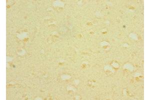 Immunohistochemistry of paraffin-embedded human brain tissue using ABIN7169531 at dilution of 1:100