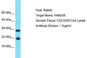 Host: Rabbit Target Name: FAM25E Sample Tissue: Human COLO205 Whole Cell Antibody Dilution: 1ug/ml (FAM25E anticorps  (C-Term))
