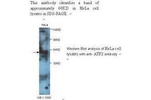 Image no. 1 for anti-Glial Cell Line Derived Neurotrophic Factor (GDNF) antibody (ABIN790851) (GDNF anticorps)