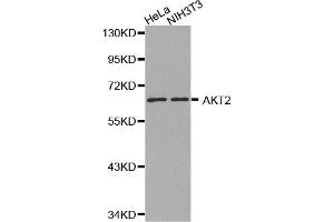 Western blot analysis of extracts of various cell lines, using AKT2 antibody. (AKT2 anticorps)