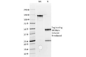 SDS-PAGE Analysis Purified ROR2 Mouse Monoclonal Antibody (ROR2/1912).
