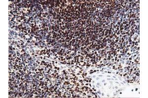 Image no. 1 for anti-Myocyte Enhancer Factor 2C (MEF2C) antibody (ABIN1499366)