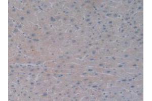 DAB staining on IHC-P; Samples: Human Liver Tissue. (BMP10 anticorps  (AA 315-424))
