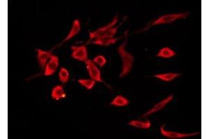 ABIN6276275 staining HepG2 by IF/ICC. (PTGDR anticorps  (Internal Region))