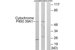 Western blot analysis of extracts from LOVO cells and HUVEC cells, using CYP39A1 antibody.