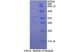 SDS-PAGE analysis of Human ENPP2 Protein. (ENPP2 Protéine)