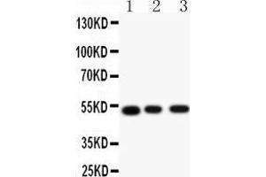 Anti-Muscarinic Acetylcholine Receptor 2 antibody, Western blotting All lanes: Anti Muscarinic Acetylcholine Receptor 2 () at 0. (Muscarinic Acetylcholine Receptor M2 anticorps  (C-Term))