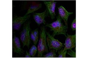 Image no. 2 for anti-V-Akt Murine Thymoma Viral Oncogene Homolog 1 (AKT1) (pThr450) antibody (ABIN319271) (AKT1 anticorps  (pThr450))