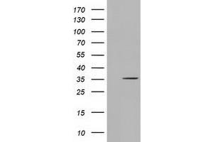 Western Blotting (WB) image for anti-Short Chain Dehydrogenase/reductase Family 9C, Member 7 (SDR9C7) antibody (ABIN1500840) (SDR9C7 anticorps)