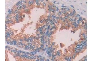 Detection of CBG in Human Prostate Tissue using Polyclonal Antibody to Corticosteroid Binding Globulin (CBG) (SERPINA6 anticorps  (AA 218-378))