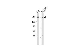 All lanes : Anti-PBRM1 Antibody (C-term) at 1:2000 dilution Lane 1: F9 whole cell lysates Lane 2: NCCIT whole cell lysates Lysates/proteins at 20 μg per lane. (Polybromo 1 anticorps  (C-Term))
