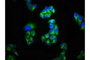 Immunofluorescence staining of Hela cells with ABIN7163932 at 1:100, counter-stained with DAPI. (KCNK3 anticorps  (AA 278-379))