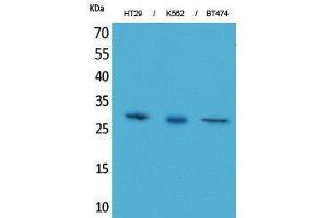 Western Blotting (WB) image for anti-Breast Cancer Metastasis-Suppressor 1-Like (BRMS1L) (C-Term) antibody (ABIN3178189) (BRMS1L anticorps  (C-Term))
