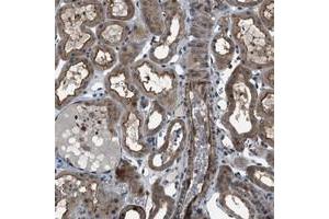 Immunohistochemical staining of human kidney with TMEM132C polyclonal antibody  shows cytoplasmic and membranous positivity in renal tubules. (TMEM132C anticorps)