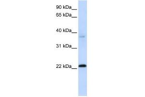 C11ORF74 antibody used at 1 ug/ml to detect target protein. (C11ORF74 anticorps  (Middle Region))