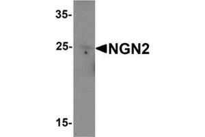 Western blot analysis of NGN2 in rat brain tissue lysate with NGN2 Antibody  at 1 μg/mL (Neurogenin 2 anticorps  (C-Term))
