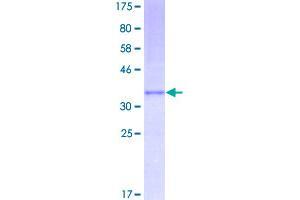 Image no. 1 for Chemokine (C-C Motif) Ligand 2 (CCL2) (AA 1-99) protein (GST tag) (ABIN1348387)