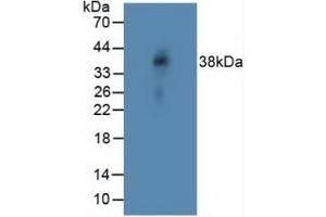 Western blot analysis of Rat Vein Tissue. (NOTCH4 anticorps  (AA 1715-2001))