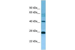 WB Suggested Anti-MRPL38 Antibody Titration: 1. (MRPL38 anticorps  (C-Term))