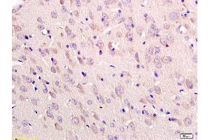 Formalin-fixed and paraffin embedded rat brain labeled with Anti-Tubulin-beta Polyclonal Antibody, Unconjugated (ABIN726320) at 1:200 followed by conjugation to the secondary antibody and DAB staining (TUBB anticorps  (AA 1-50))