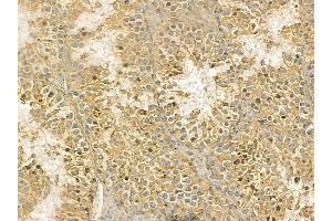 TUBA4A Mouse Monoclonal Antibody at 1/100 staining mouse testis tissue by IHC-P. (TUBA4A anticorps)